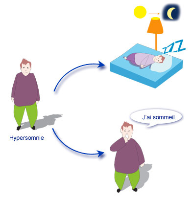 pathologies du sommeil